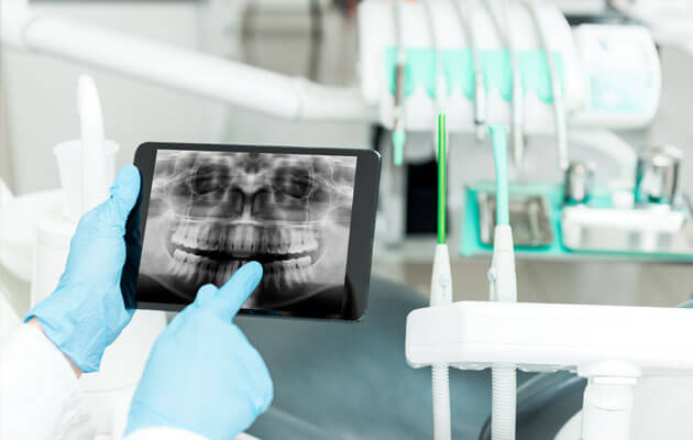 dentist pointing at xray of teeth